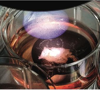 Microgravity research pioneers the future of medicine. In 2024, Redwire Space bio-printed its first live human heart tissue using the 3D BioFabrication Facility (BFF).
